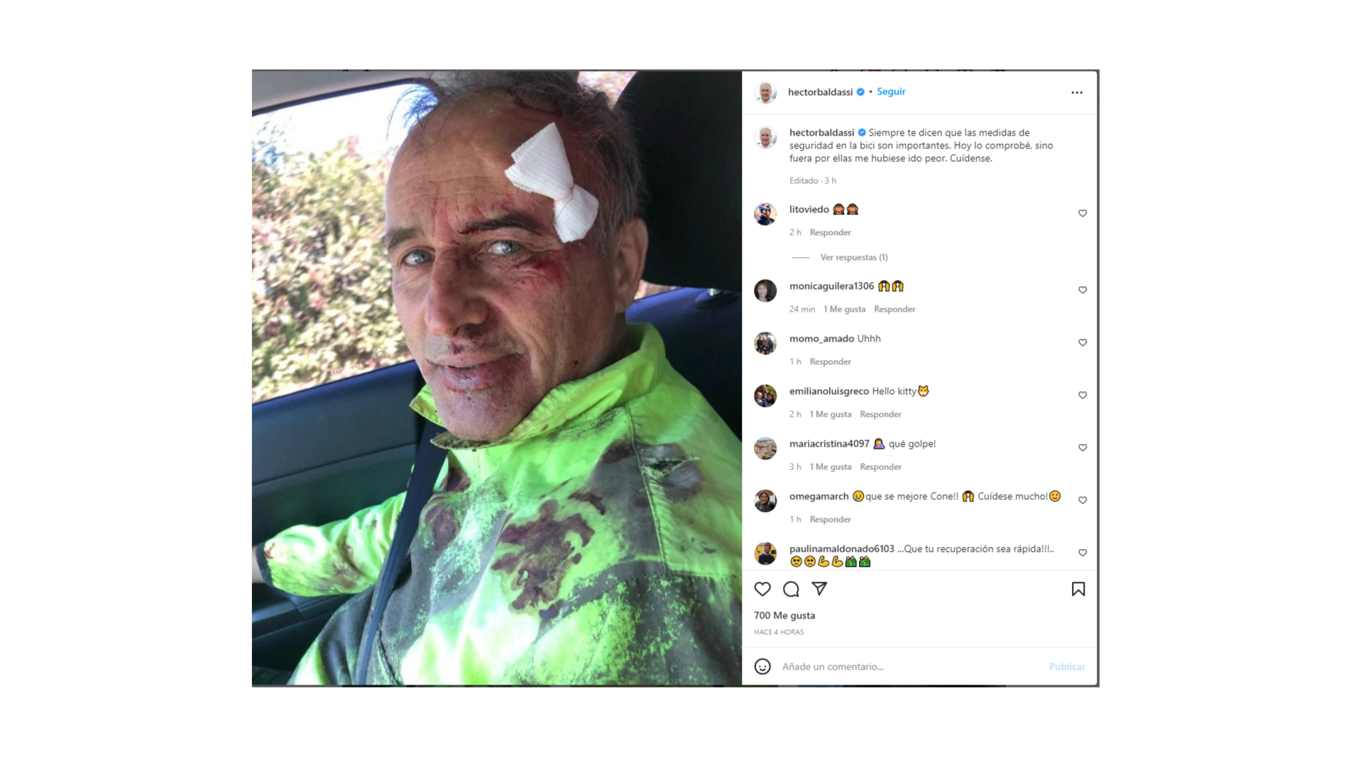 El diputado Héctor Baldassi sufrió un accidente en bicicleta • Canal C