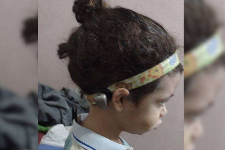 Le robaron los audífonos a un niño de 3 años con hipoacusia: cómo ayudar • Canal C